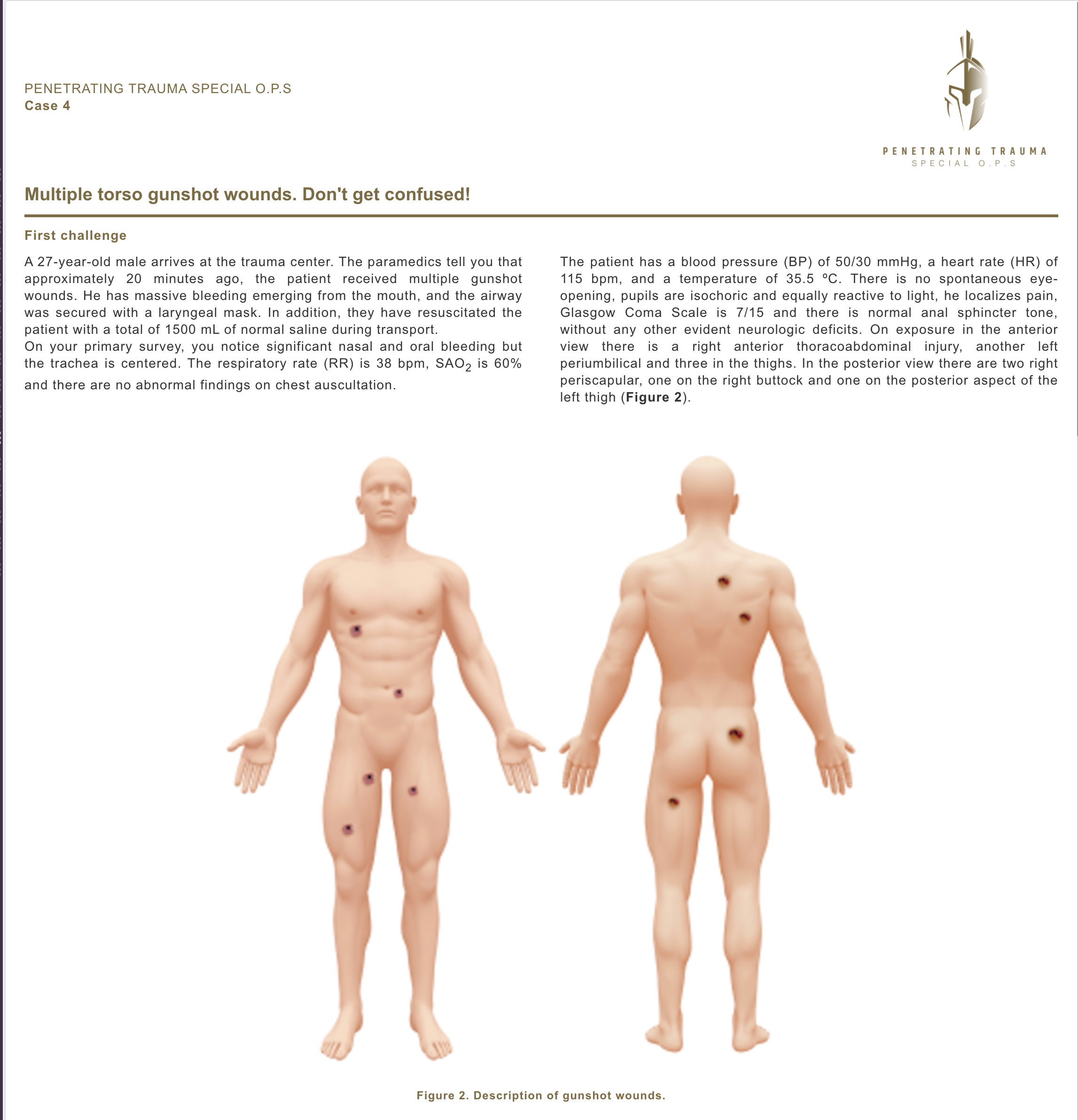 Case 4 (EN): Multiple torso gunshot wounds. Don't get confused!