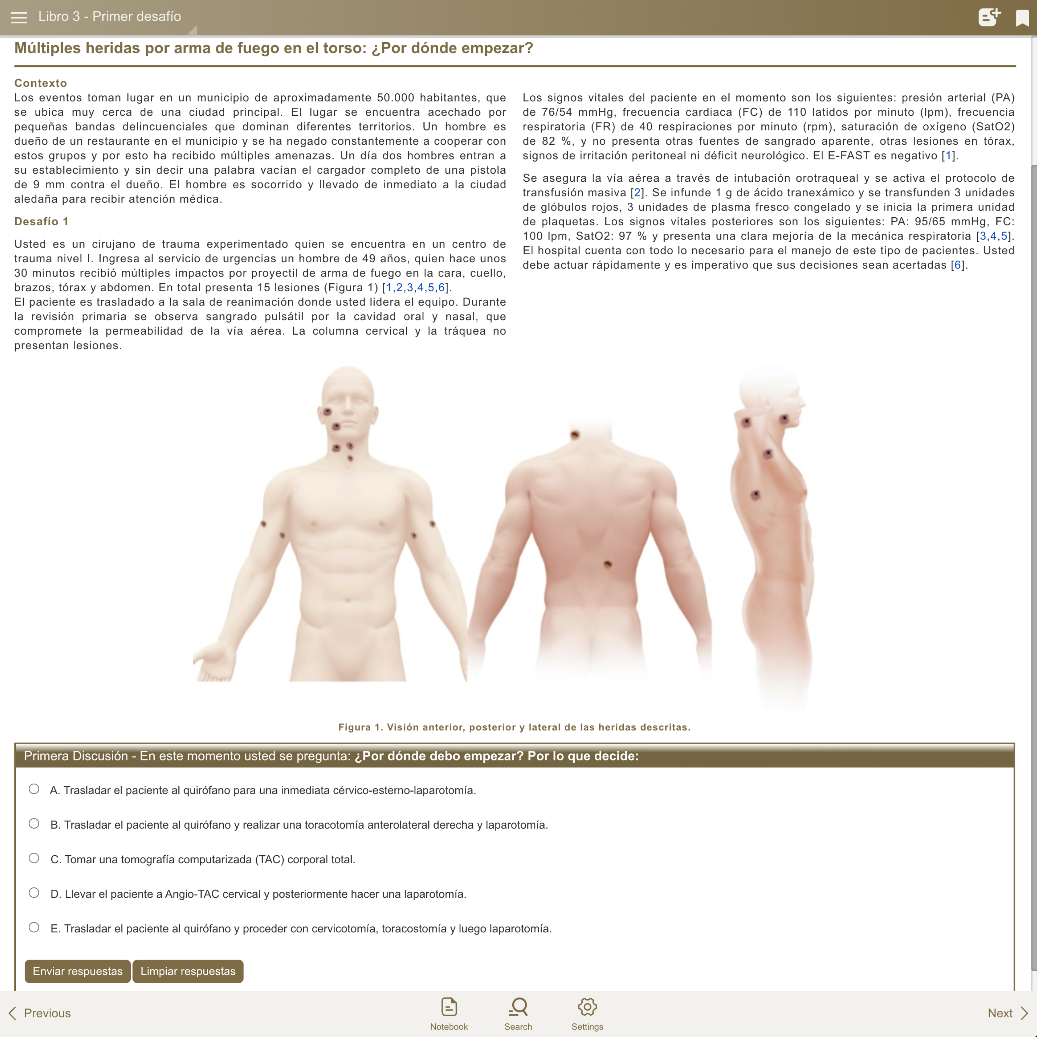 Caso 3 (ES): Múltiples heridas por arma de fuego en el torso. Por dónde empezar?
