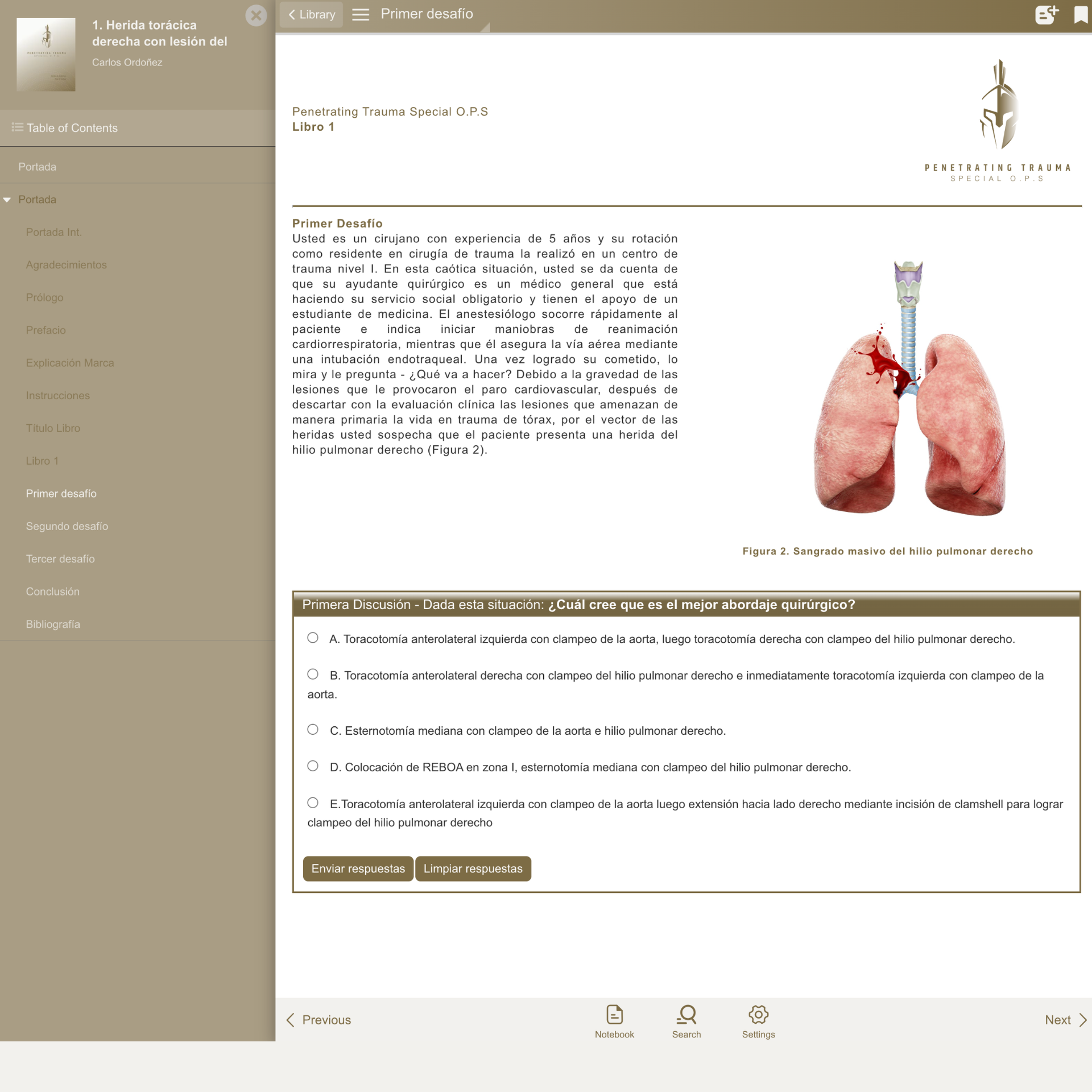 Caso 1 (ES): Herida torácica derecha con lesión del hilio pulmonar